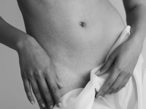 Depiliacija – „nuogojo" sezono procedūra