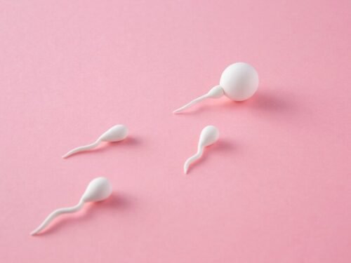 Kokia yra priešlaikinio spermos išsiskyrimo priežastis