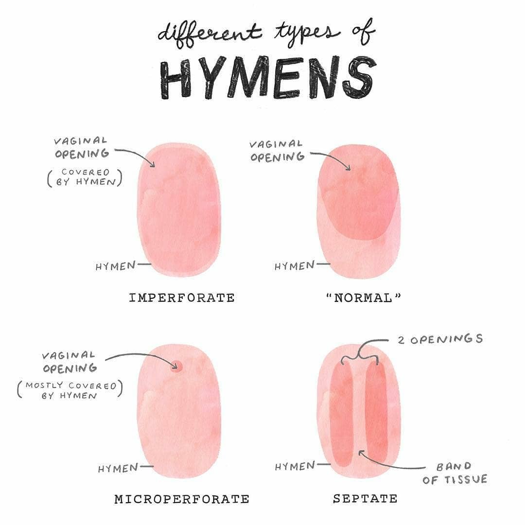Kas yra mergystės plėvė ir kodėl ji reikalinga: faktai apie moters anatomiją, kuriuos naudinga žinoti kiekvienam. „Nekaltybės“ sąvoka turi sudėtingą istoriją.