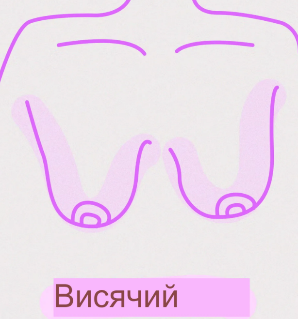 Pasaulyje yra 8 skirtingų tipų krūtys – štai ką reikia žinoti. 4. Nukarusios krūtys (nukritusios)