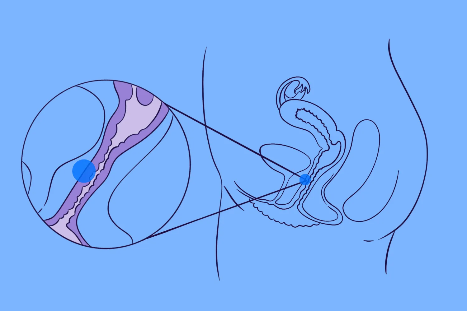 Illustration of the G-spot