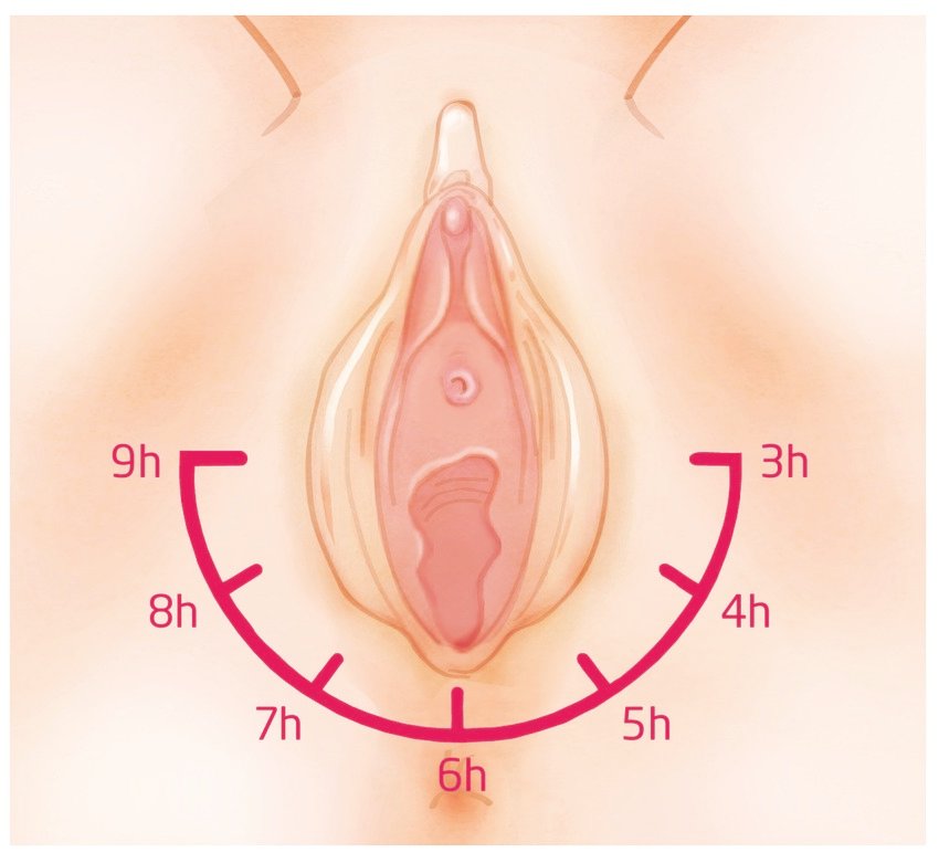 Perineal Massage Application Diagram