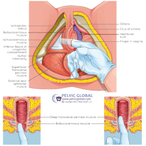 Pelvic Floor Rehabilitation
