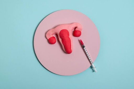 vaginismus treatment