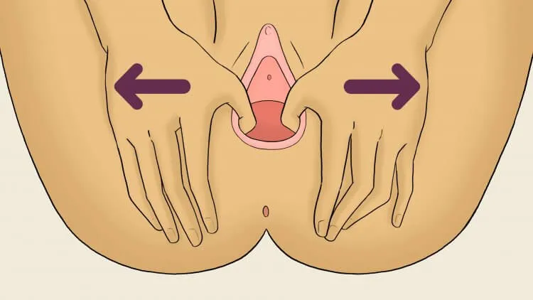 Perineal massage instructions illusrtation sides